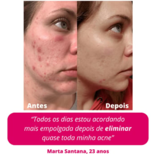Cópia de PG VD (4)